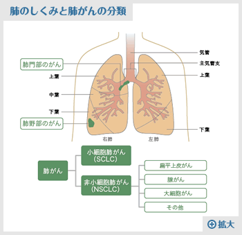 肺のしくみと肺がんの分類